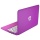 HP Stream 11-d002ng 29,4 cm 11,6 Zoll Netbook Bild 4